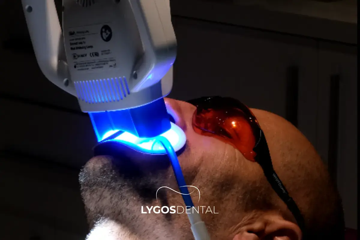 Tooth Whitening What We Now Know