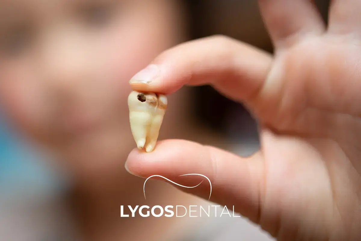 What Happens If a Tooth That Should Be Extracted Is Not Removed