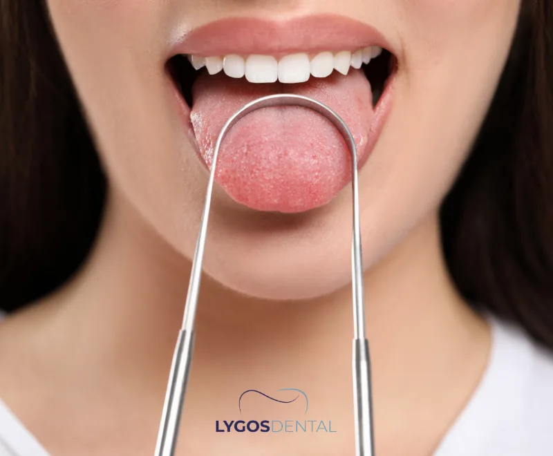 Wie wirkt sich die Verwendung eines Zungenreinigers auf die Zahngesundheit aus?