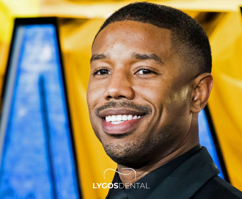Facetas dentárias de Michael B. Jordan