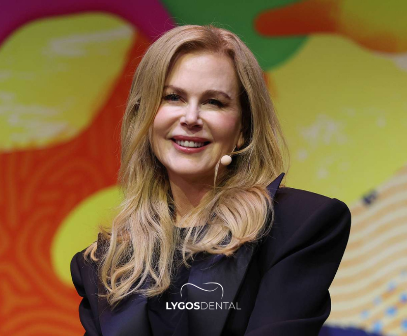 De transformatie van Nicole Kidman’s gebit | LYGOS DENTAL