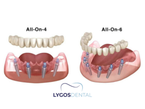 All On Six 2 All On Six