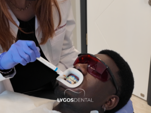 Diş Beyazlatma 2 Diş Beyazlatma