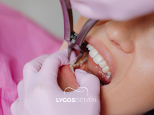 Diş Çekimi 2 Diş Çekimi