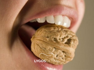 Gülüş Tasarımı 4 Gülüş Tasarımı