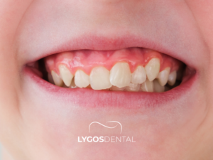 Ortodontik Tedavi 2 Ortodontik Tedavi