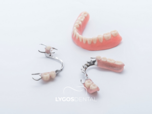 Hareketli Protez 2 Hareketli Protez