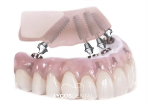 All On Four 3 All On Four