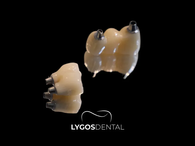 Implant ve Zirkonyum Kaplama Uyumu