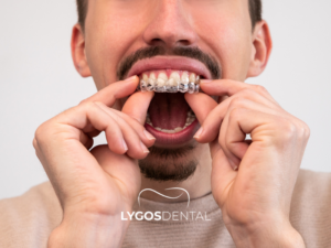 Şeffaf Plak 2 Şeffaf Plak