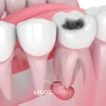 Стоматологическое поражение