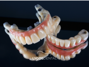 İmplant Üstü Protez