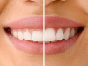 Pembe Estetik 1 Pembe Estetik