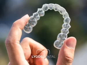 Plaque Treatment