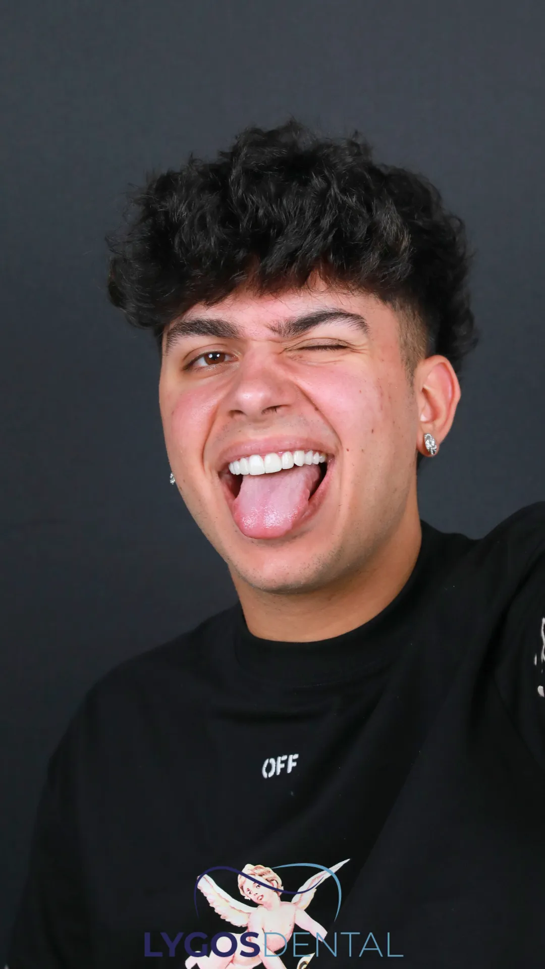 Transformación de la sonrisas 1