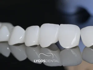Zirconia Crown