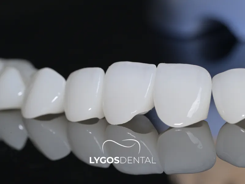 Zirconia Crown