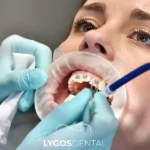 Istanbul Braces Treatment