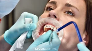 Istanbul Braces Treatment