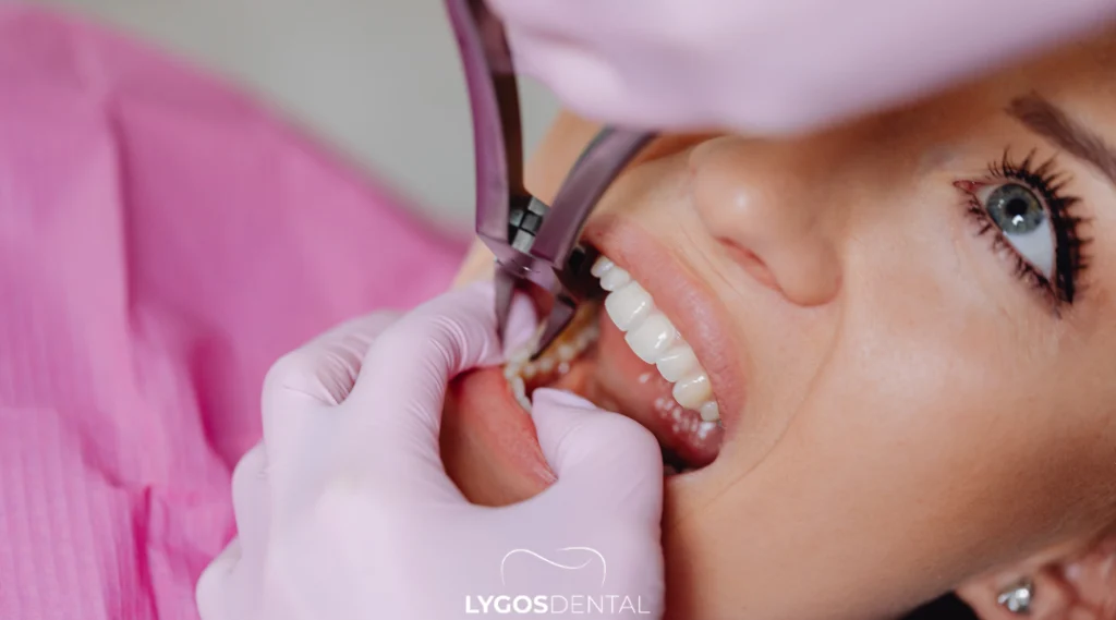 Özelde Diş Çekimi Fiyatı Ne Kadar?