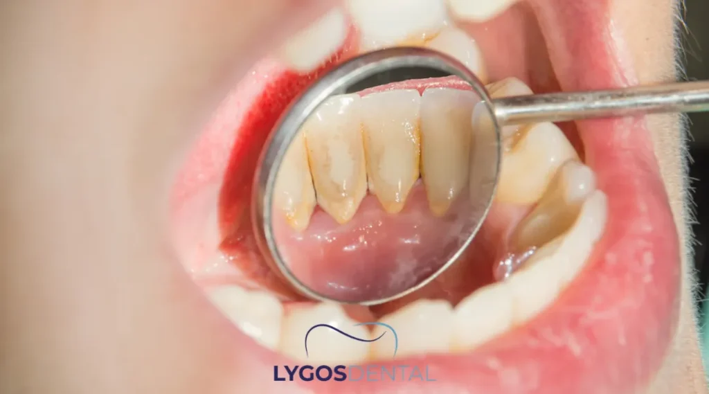 Randevuyu ertelememeniz gerektiğini anlatan işaretler