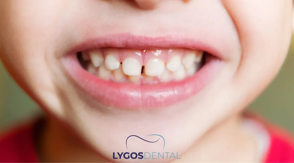 İstanbul Çocuk Diş Doktoru