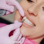 Yenibosna Porcelain Teeth: What to Expect