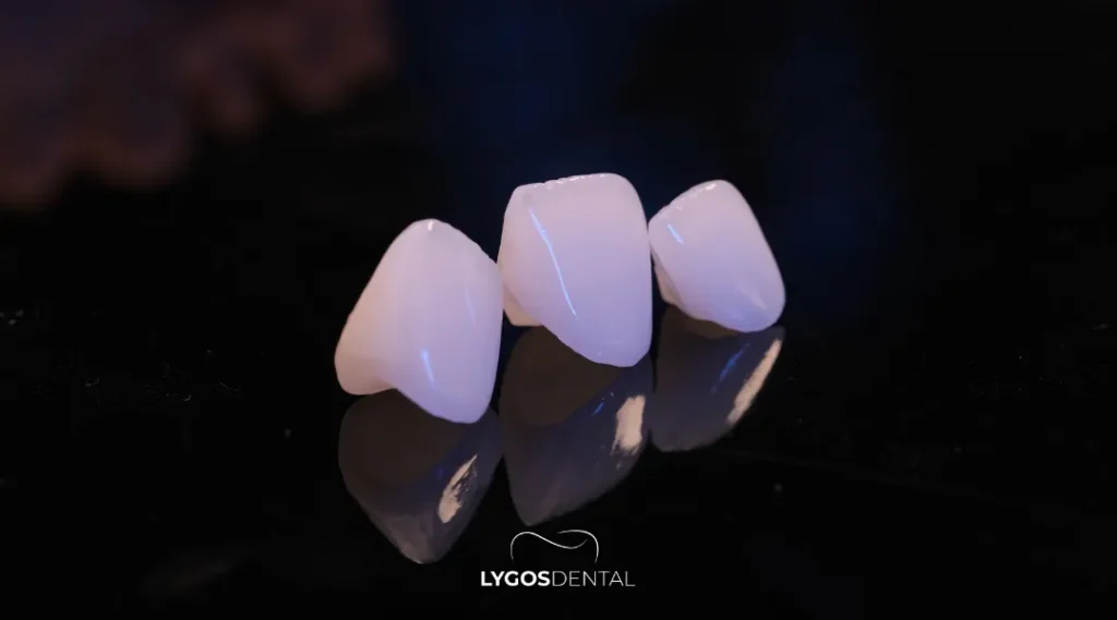 İstanbul Gülüş Tasarımı: Klinikler ve 2026 Fiyatları