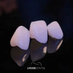 Istanbul Smile Design Clinics and 2026 Prices