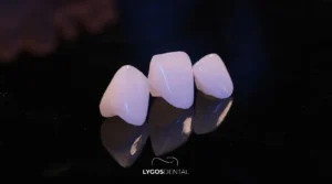 istanbul smile design clinics and prices