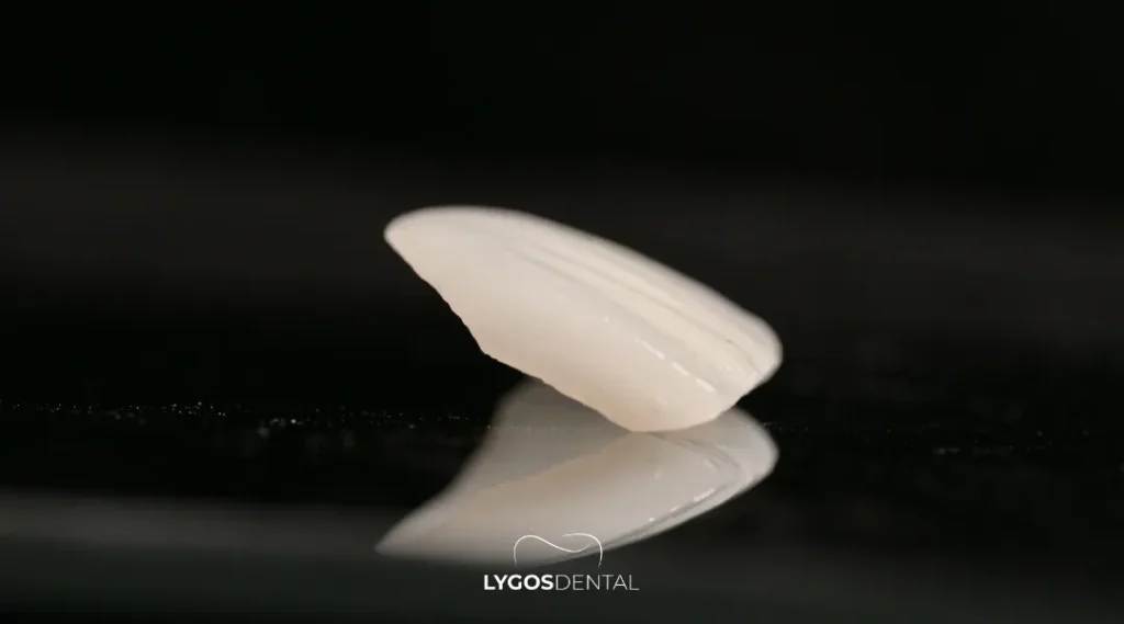 Istanbul Smile Design Clinics and 2026 Prices