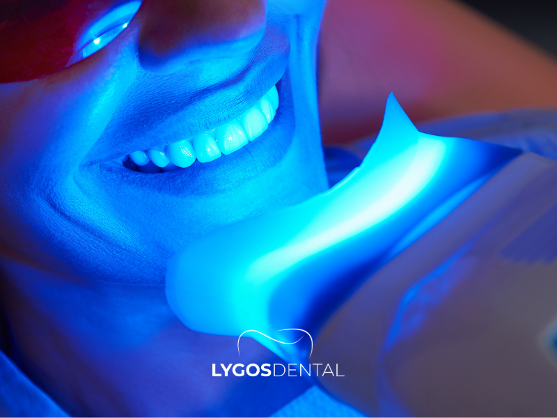 Clareamento dental