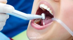 Dental Filling in Bakırköy A Practical Guide