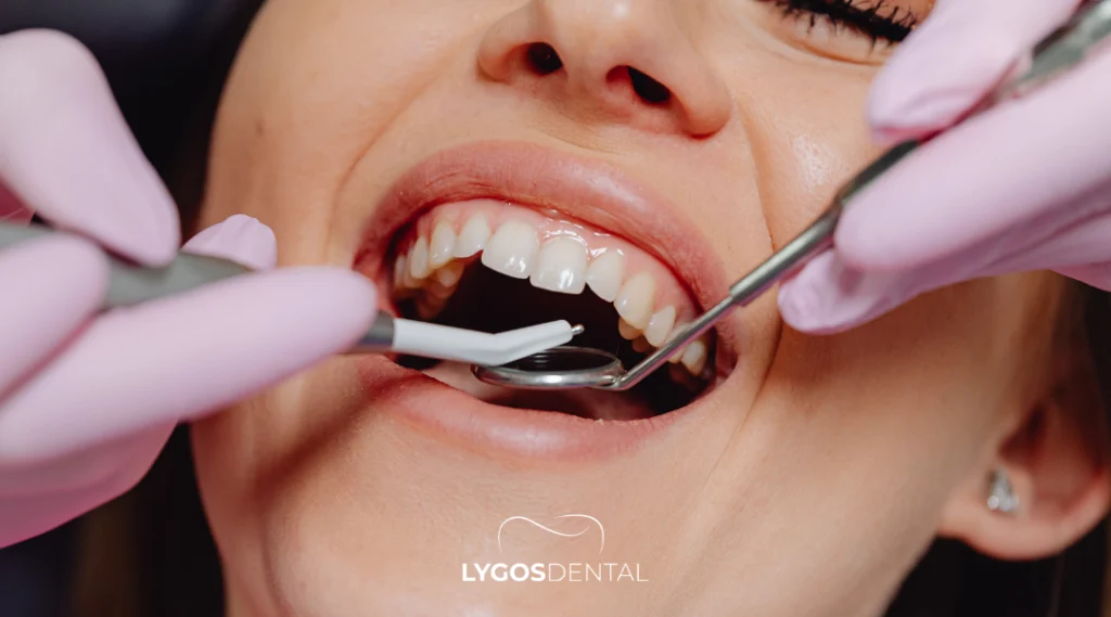 Recovery After Tooth Extraction in Bakırköy