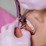 Tooth Extraction Prices in Istanbul: A Clear Guide