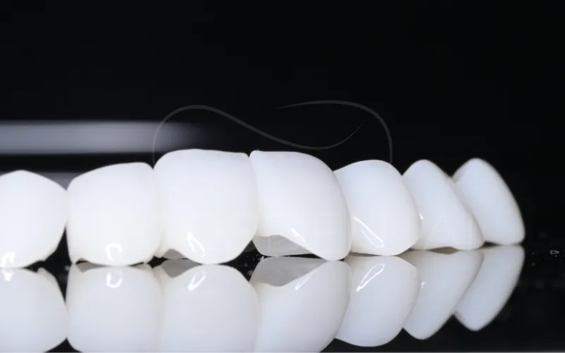 dental crown solutions