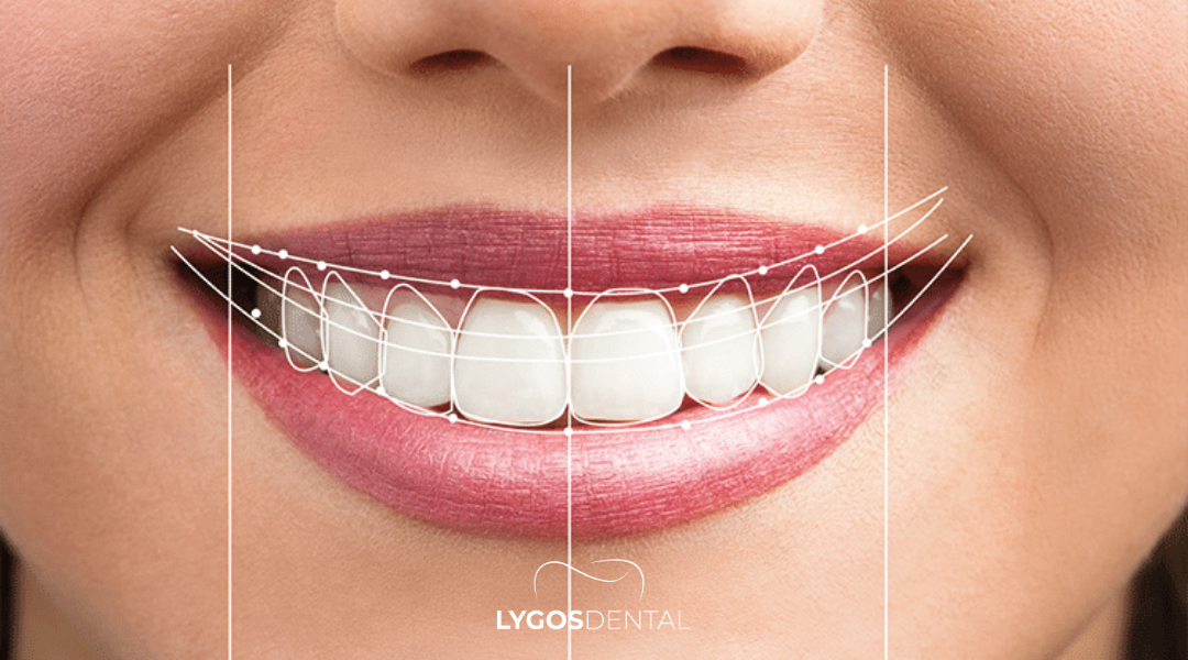 Izmir Smile Design: A Comprehensive Guide to Your New Smile