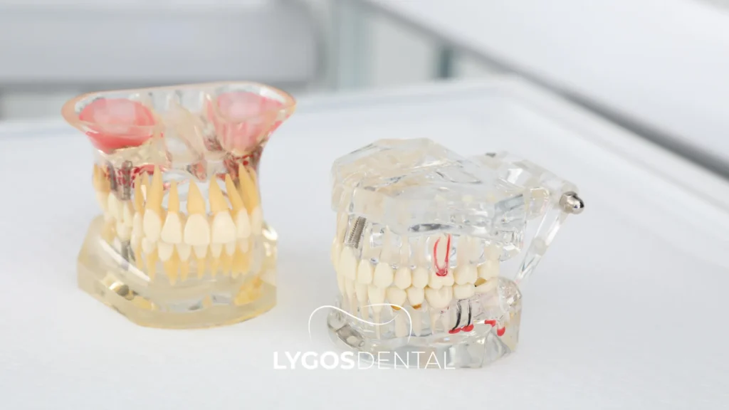 lygos dental clinic