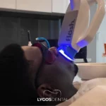 Ankara Teeth Whitening: A Comprehensive Guide