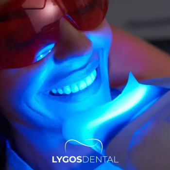 Chemical Teeth Whitening Methods