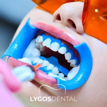 Physical Teeth Whitening Methods